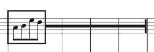 Aleatoric music